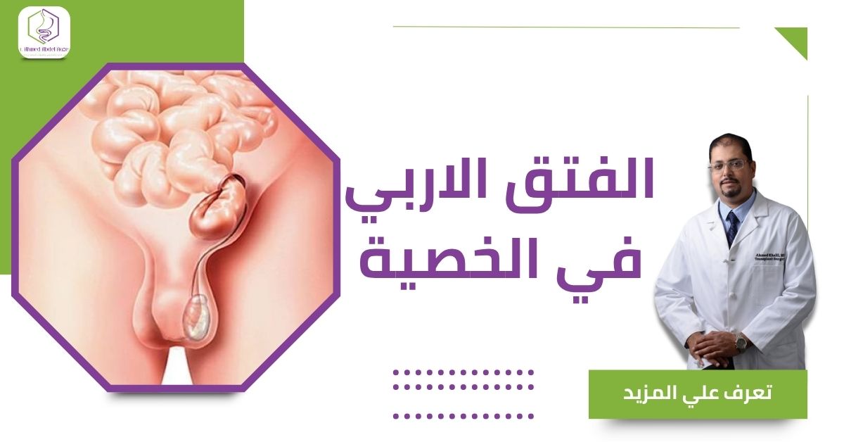 الفتق الاربي في الخصية