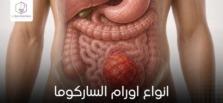 انواع اورام الساركوما