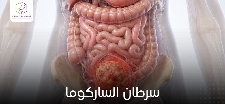 سرطان الساركوما