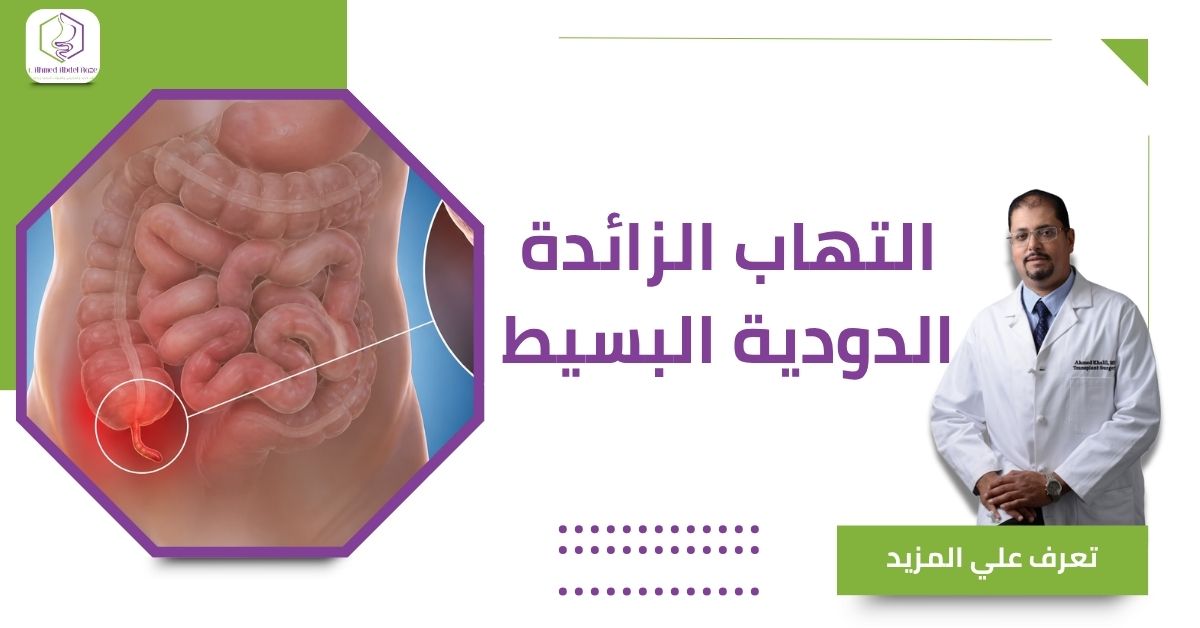 التهاب الزائدة الدودية البسيط
