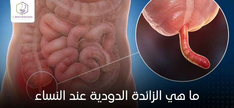 ما هي الزائدة الدودية عند النساء