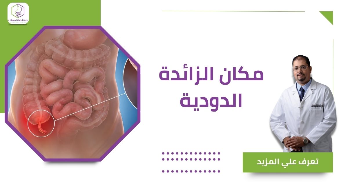 مكان الزائدة الدودية