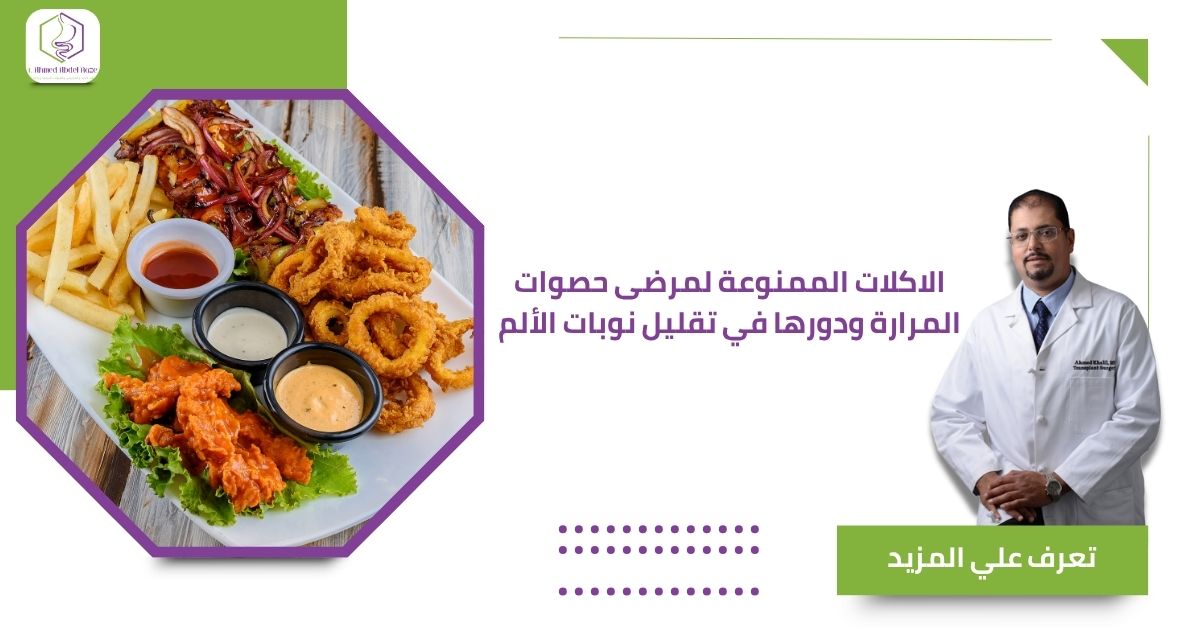 الاكلات الممنوعة لمرضى حصوات المرارة ودورها في تقليل نوبات الألم