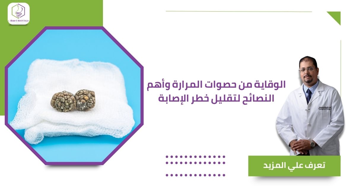 الوقاية من حصوات المرارة وأهم النصائح لتقليل خطر الإصابة