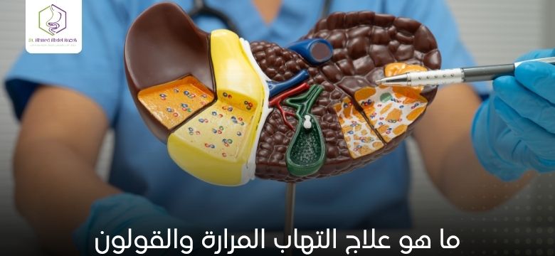 ما هو علاج التهاب المرارة والقولون