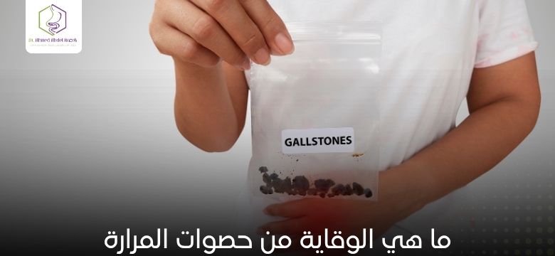 ما هي الوقاية من حصوات المرارة