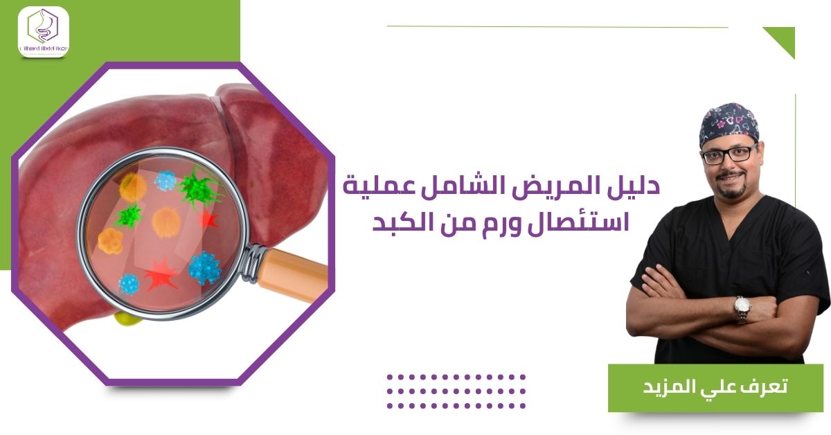 دليل المريض الشامل عملية استئصال ورم من الكبد