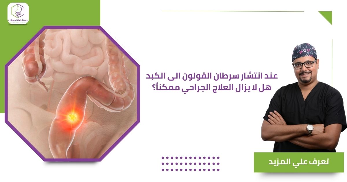 عند انتشار سرطان القولون الى الكبد هل لا يزال العلاج الجراحي ممكناً؟