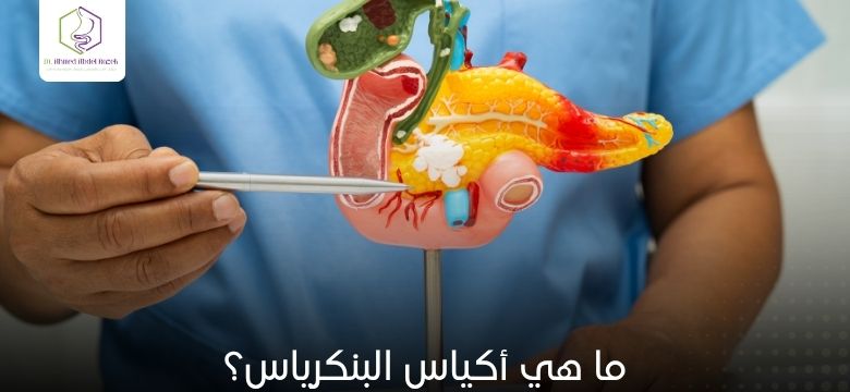 ما هي أكياس البنكرياس؟