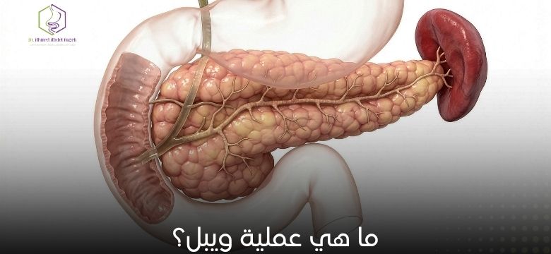 ما هي عملية ويبل؟