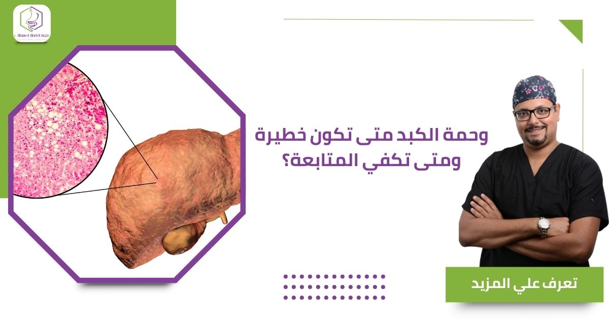 وحمة الكبد متى تكون خطيرة ومتى تكفي المتابعة؟